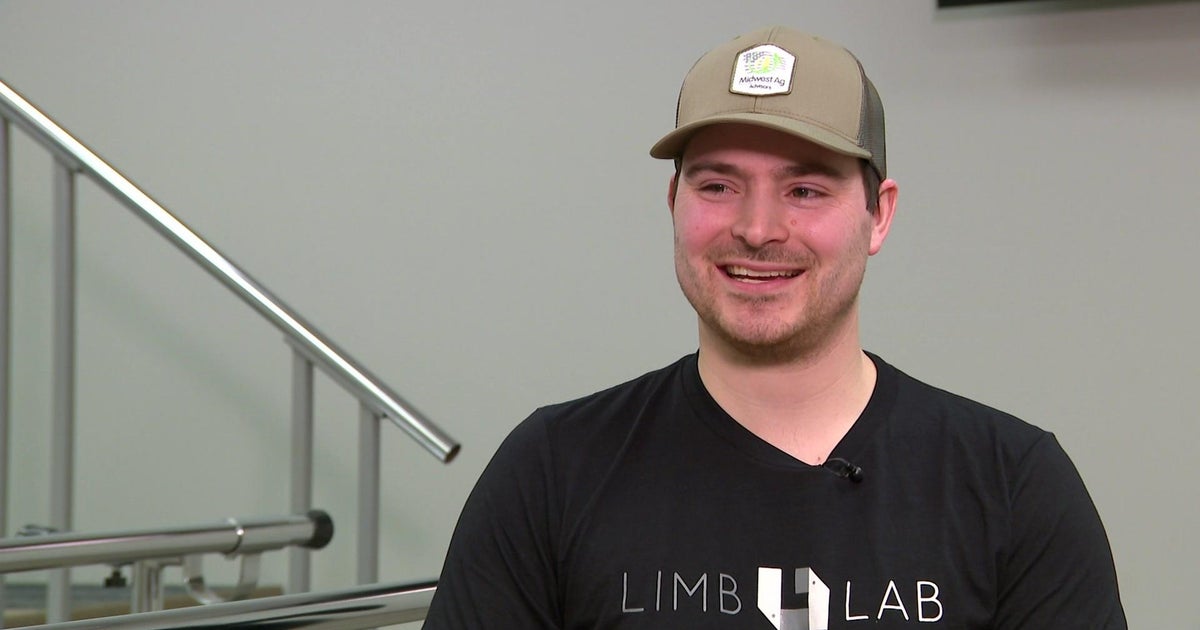 After farm accident, former Minnesota snocross racer walks again with carbon fiber legs - Vimarsana News