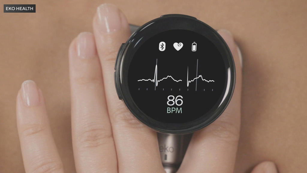 Digital stethoscope uses artificial intelligence to help doctors
detect heart valve problems