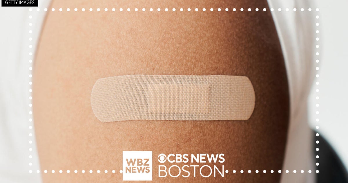 Why do I get an itchy rash from using adhesive bandages? CBS Boston