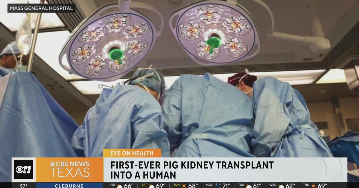First-ever pig kidney transplant into a human - CBS Texas