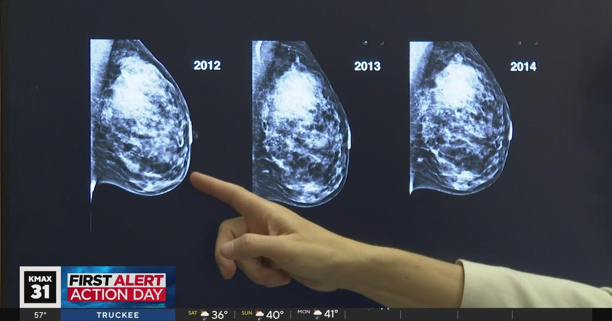 The Answer What does preventative chemotherapy mean? CBS Sacramento