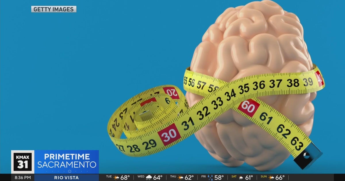 The Answer: Brains are getting bigger?