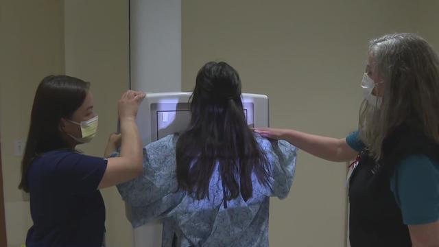 technicians perform mammogram on patient 