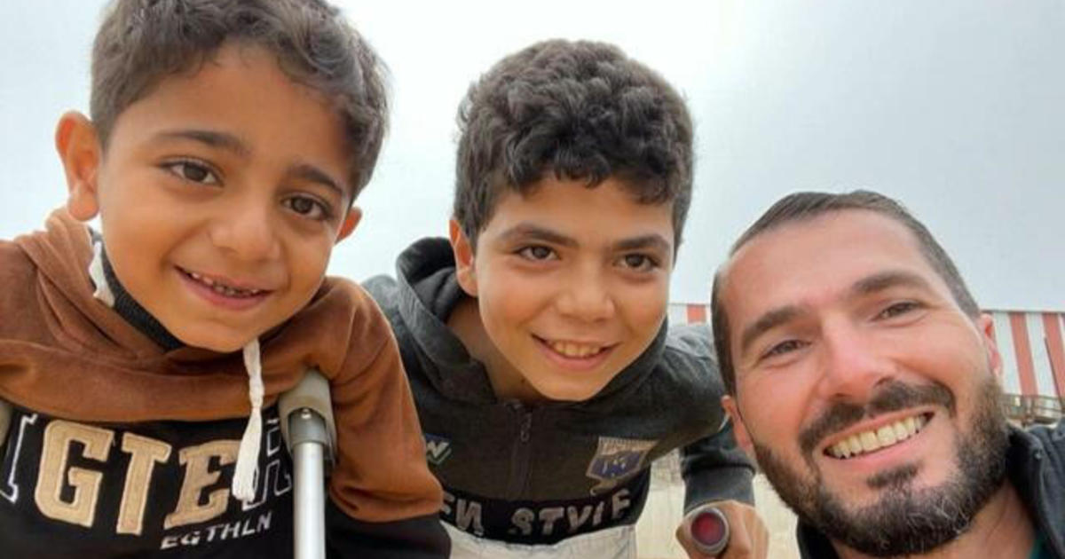 California doctor travels to Gaza to treat children injured in Israel-Hamas war
