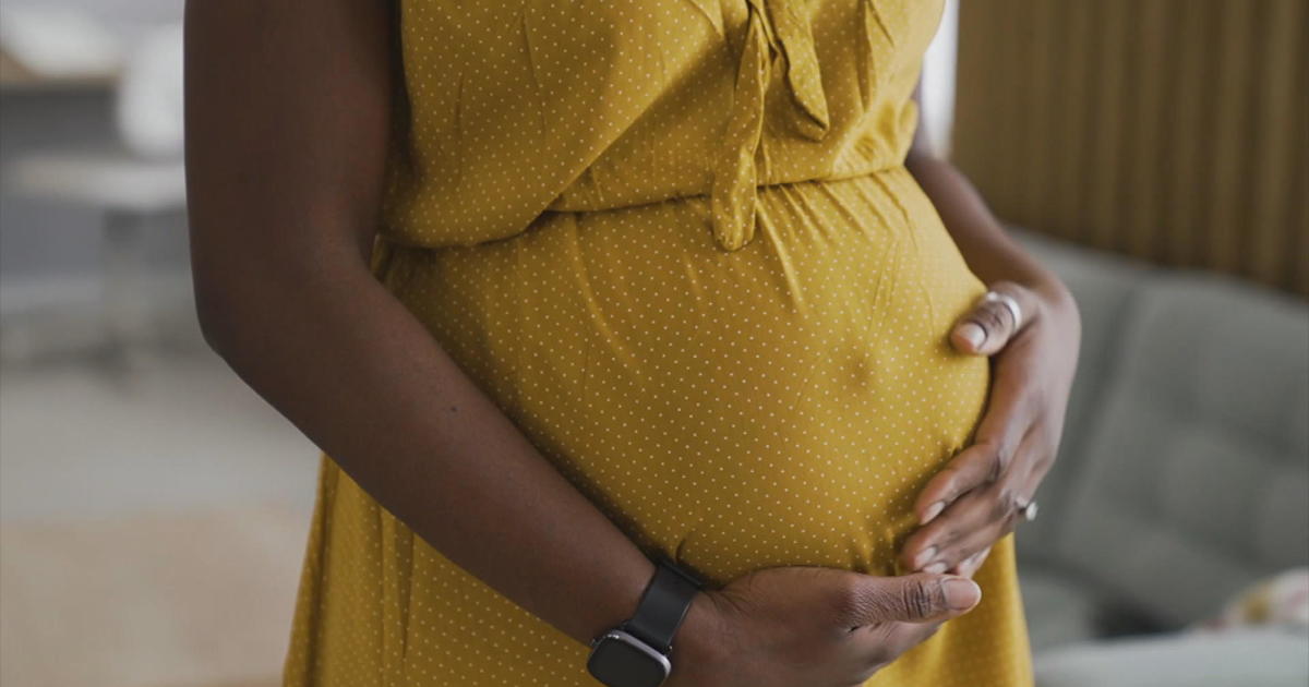 Докато смъртните случаи, свързани с бременността в САЩ, са намалели