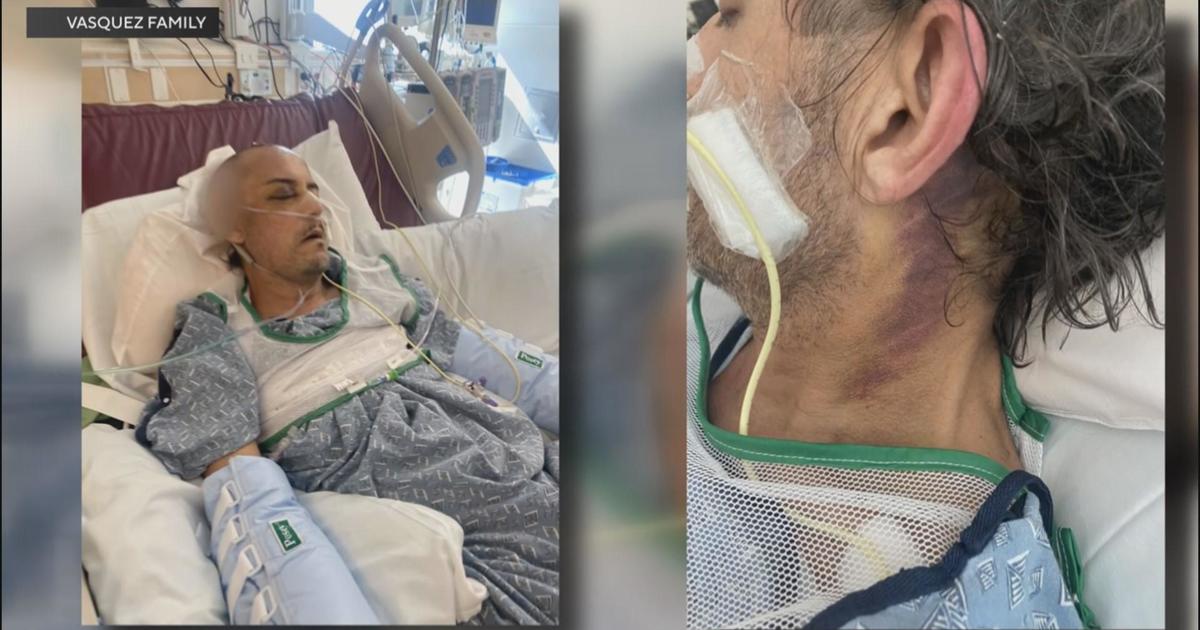 53-year-old hairdresser beaten outside West Hollywood nightclub