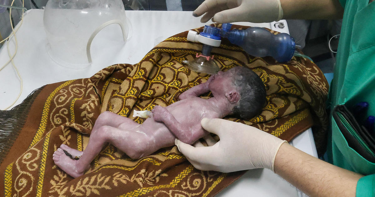 Бебе, спасено от утробата на умираща майка след израелски въздушен удар срещу град Рафа в Газа, кръстен в нейна чест