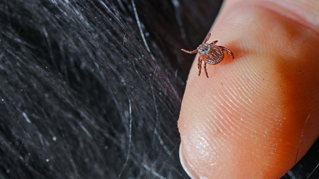 A small tick is seen on a person's finger 