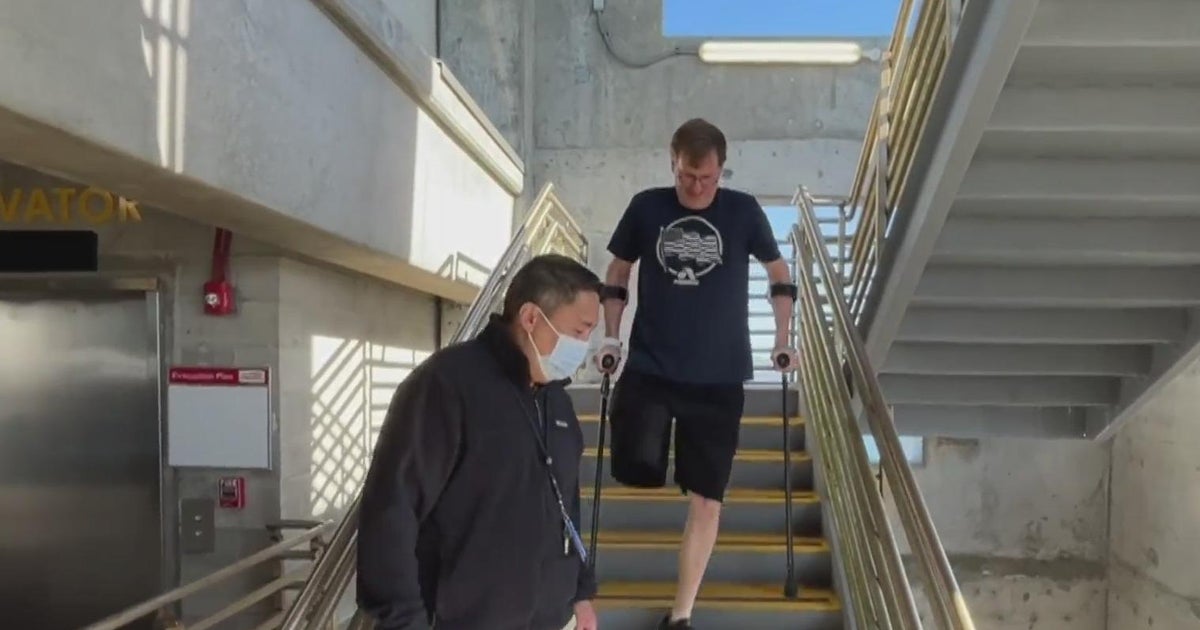 Bay Area Air Force veteran to receive groundbreaking prosthetic - CBS ...