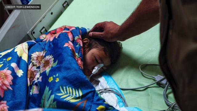 A 3-year-old girl lays in a hospital bed under a blanket with a medical device attached to her nose. 
