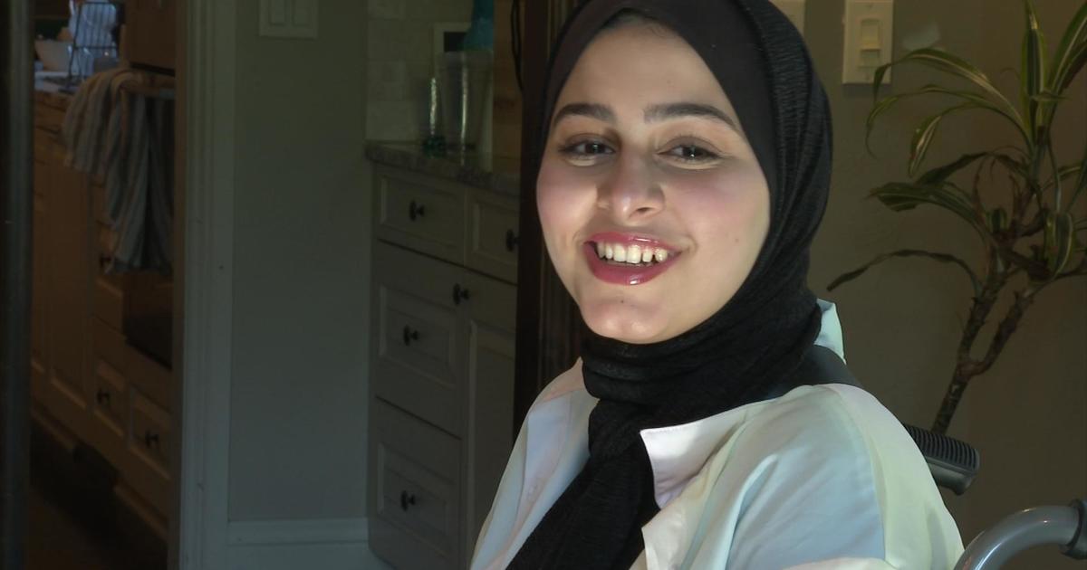 Gazan woman from viral video receives prosthetic leg in Colorado