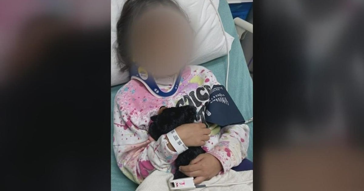 Young girl recovering after suffering serious injuries in Placerville deer incident