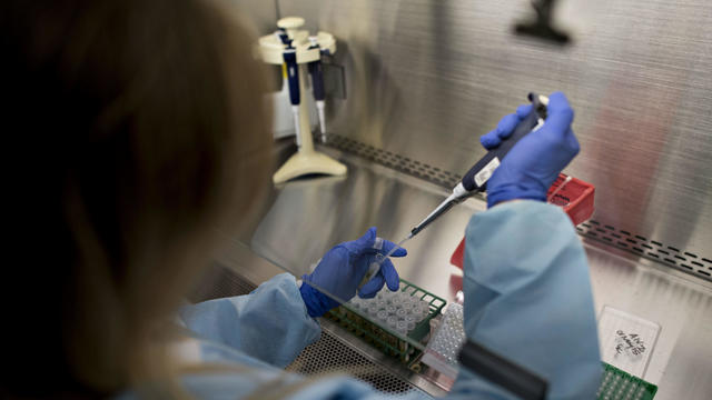 Bird Flu Samples Tested in Lab 