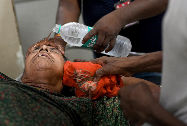 Patient treated for heatstroke in India 