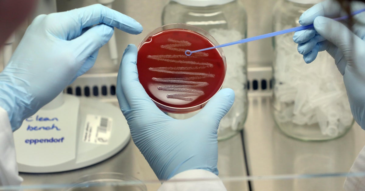 A deadly bacterial infection is spreading in Japan. Here’s what to know about causes and prevention. A deadly bacterial infection is spreading in Japan. Here’s what to know about causes and prevention.