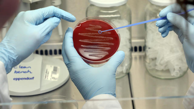 File photo: scientists testing bacteria in a lab 
