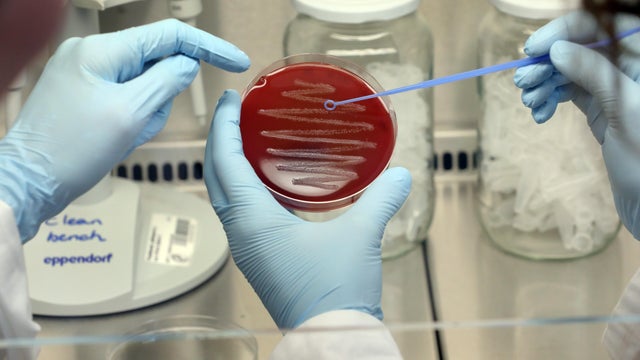 A deadly bacterial infection is spreading in Japan. Here's what to know about causes and prevention.