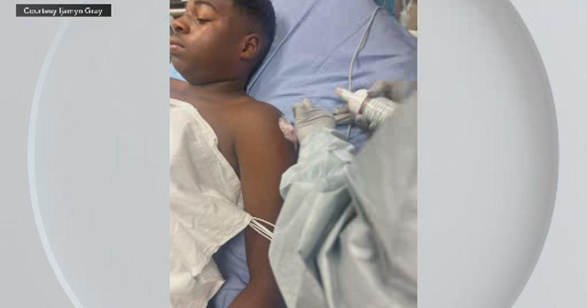 Boy, 13, struck by stray bullet on Fourth of July in Miami-Dade
