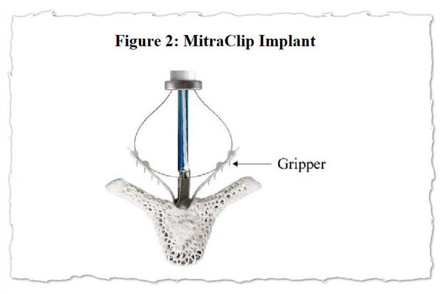 mitraclip-fda-02.jpg 