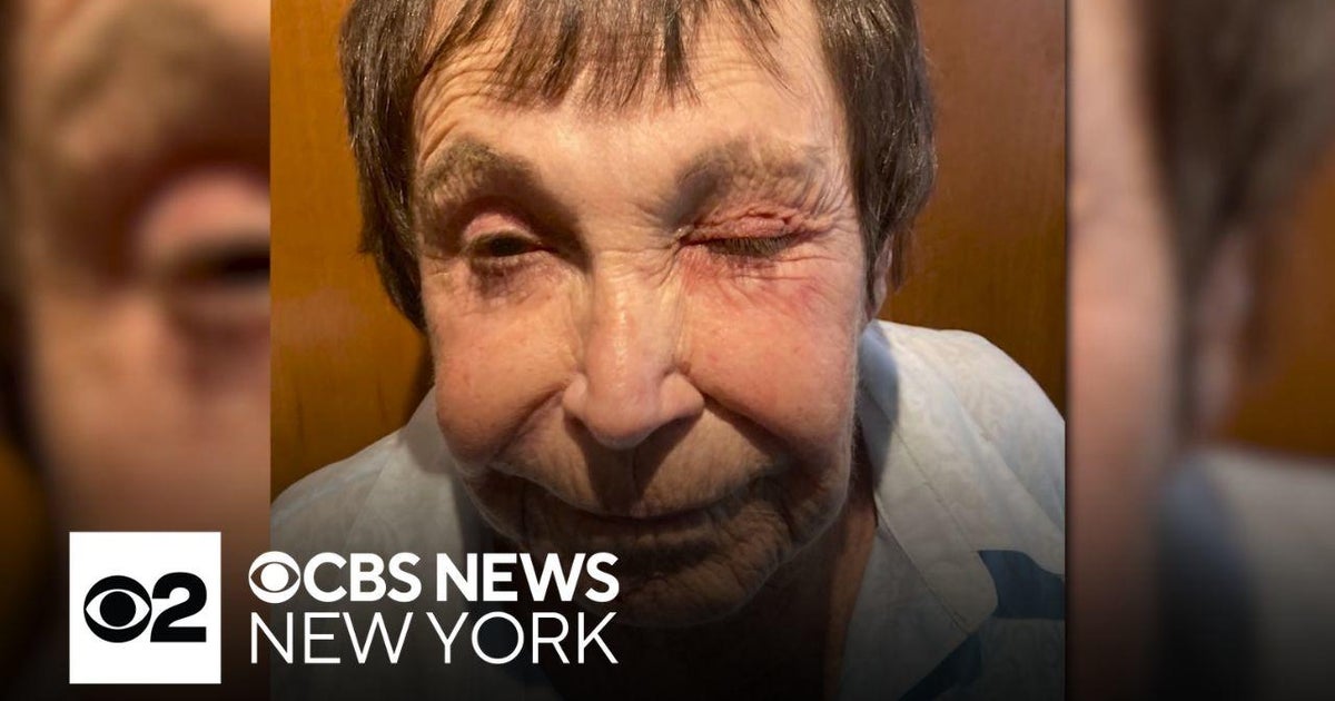 89-year-old woman randomly attacked in NYC - CBS New York