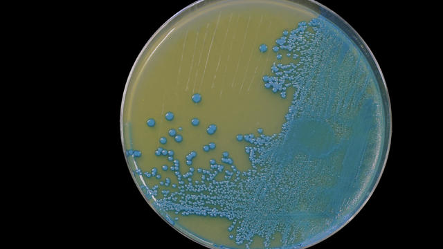 Listeria monocytogenes growing on an agar plate isolated on a black background 