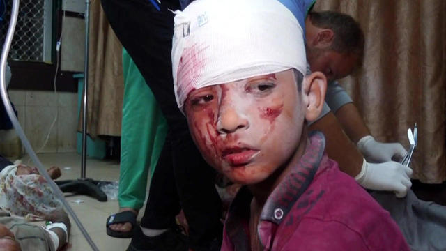 a-wounded-child-in-gaza-1280.jpg 