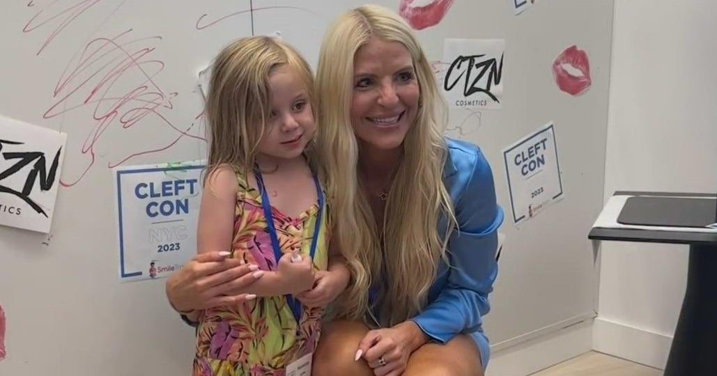 2 inspiring women turn their personal experiences with cleft palate into a mission of advocacy