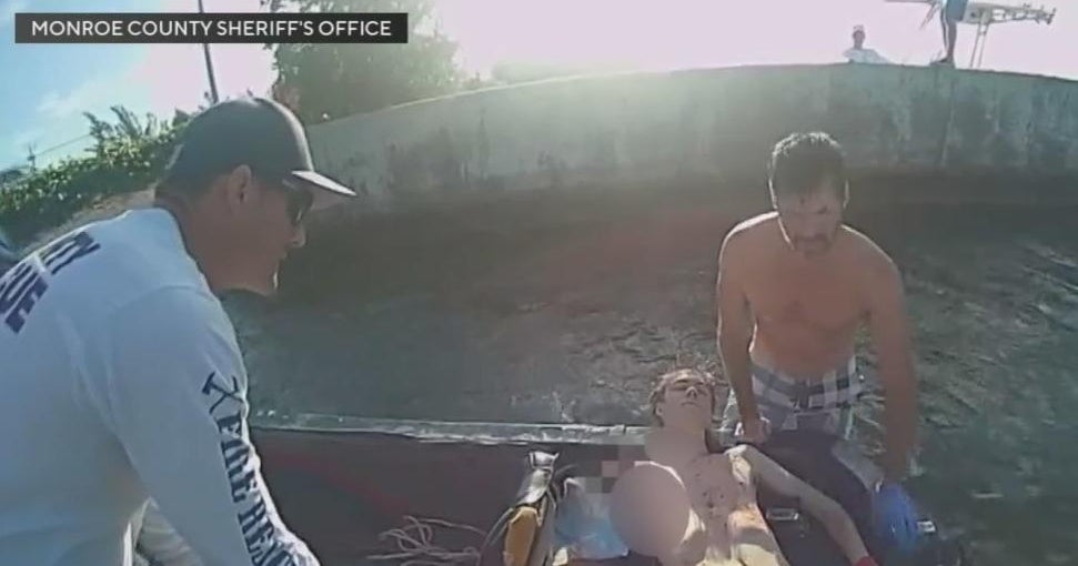 Video shows dramatic moments after diver hit by boat propeller in the Florida Keys Video shows dramatic moments after diver hit by boat propeller in the Florida Keys