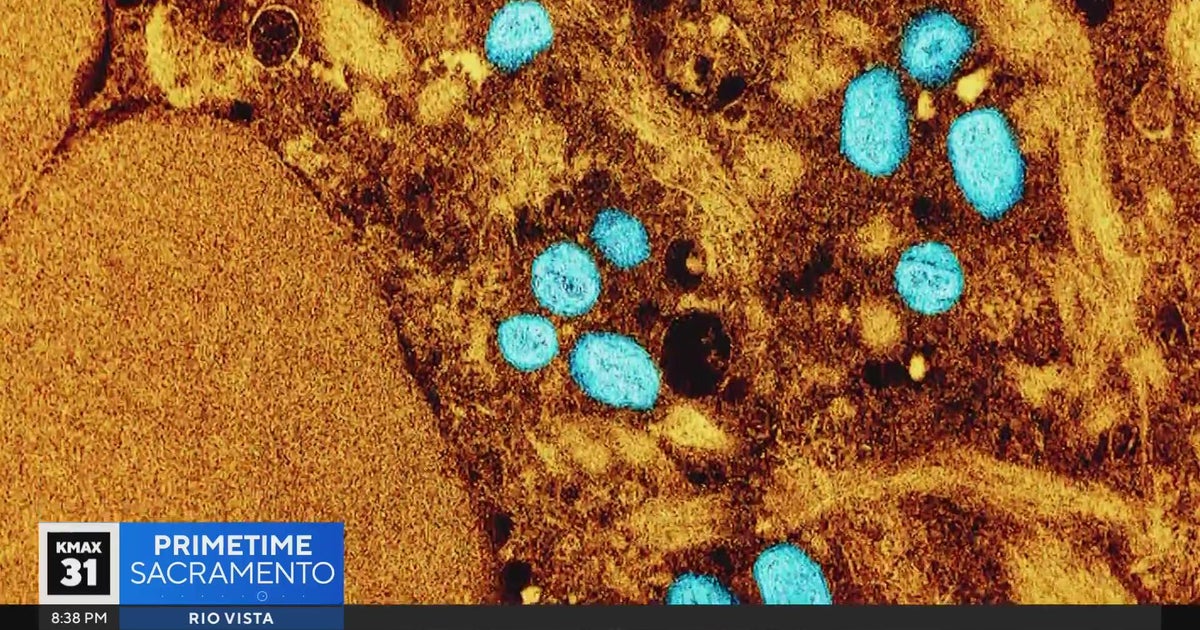 What does the MPox global health emergency mean for us? | The Answer