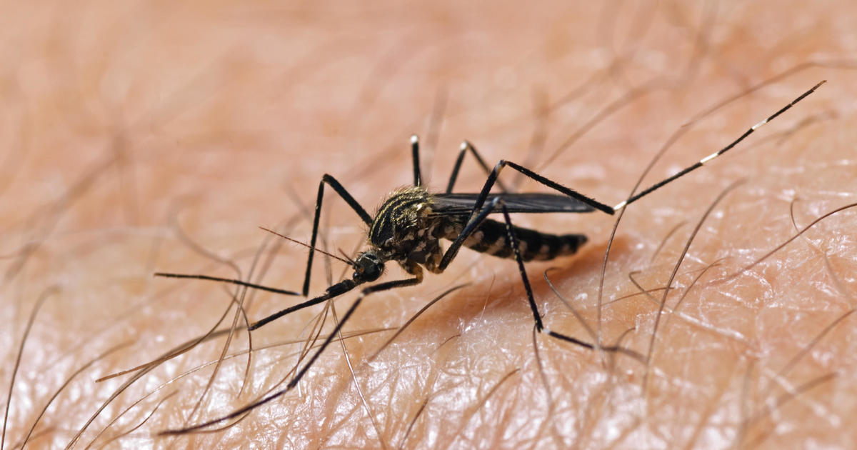 30 confirmed cases of Oropouche virus in Florida. Here’s what you need to know.