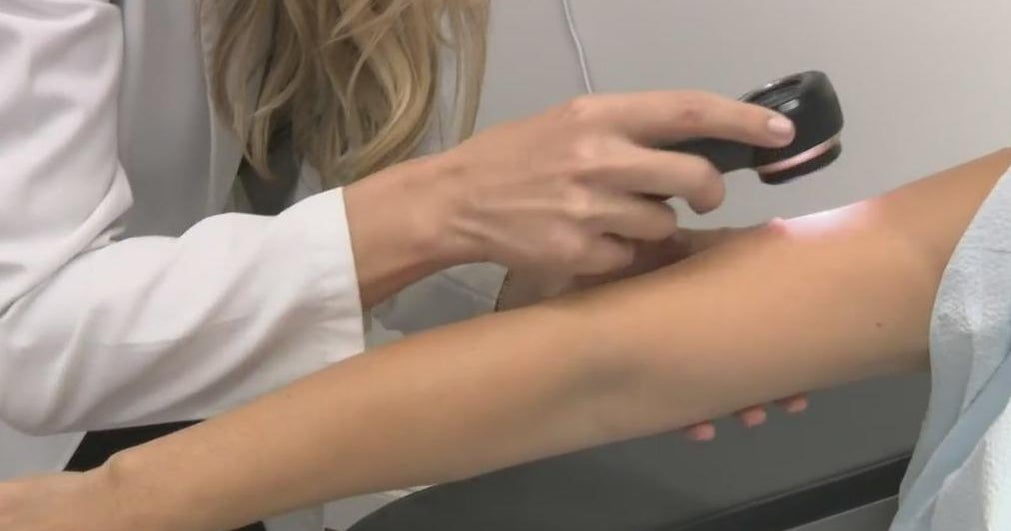 Skin checks for cancer can be a real life saver