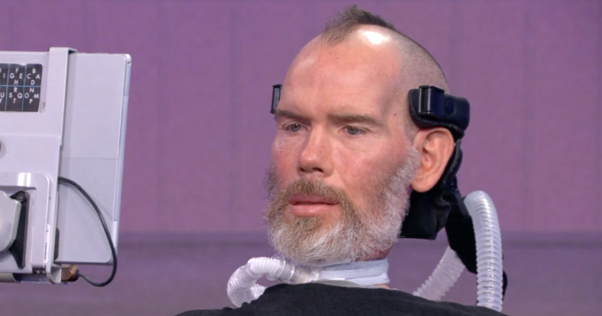 Former NFL player Steve Gleason gets candid about ALS journey: