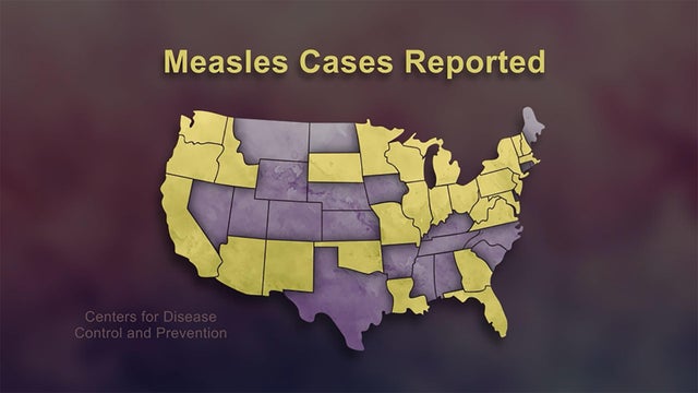 measles-cases-reported-1920.jpg