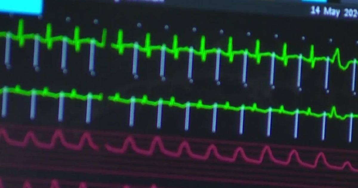 Bill would give organ donors tax breaks