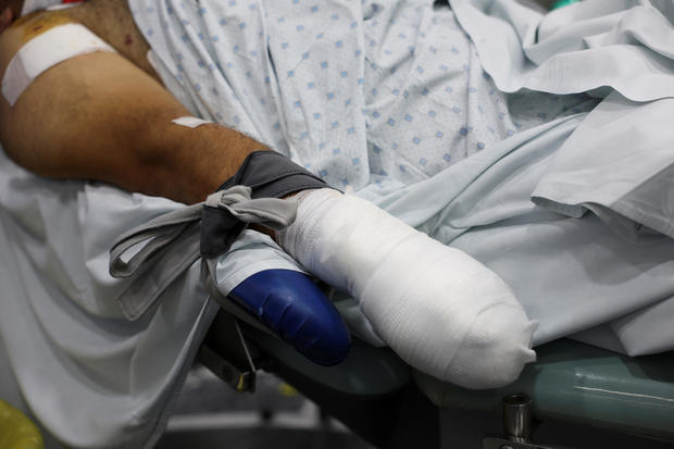 An injured man undergoes an operation, following pager detonations across Lebanon, at a hospital in Beirut 