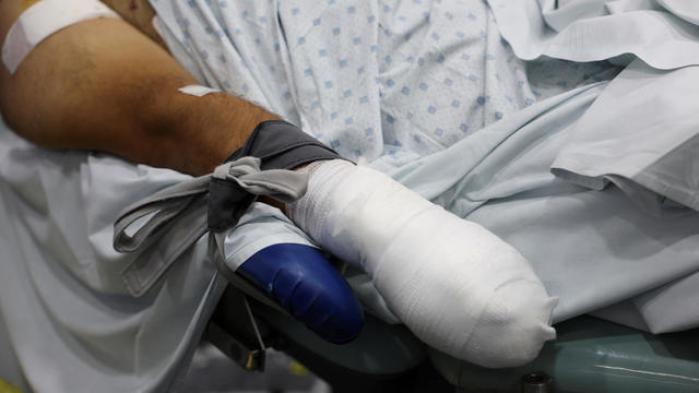 An injured man undergoes an operation, following pager detonations across Lebanon, at a hospital in Beirut 