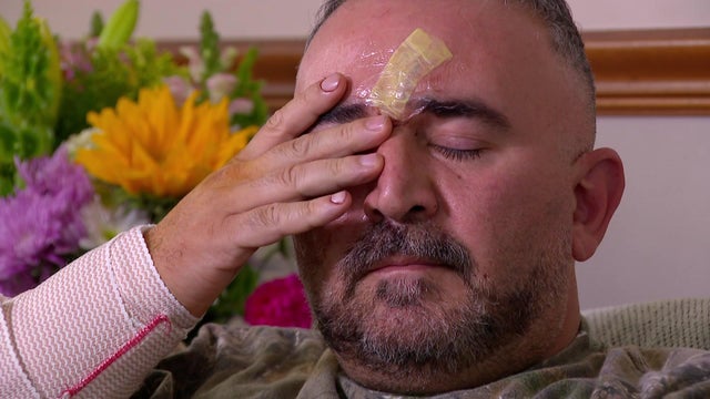 10p-pkg-dog-bite-victim-wcco6a8n.jpg 