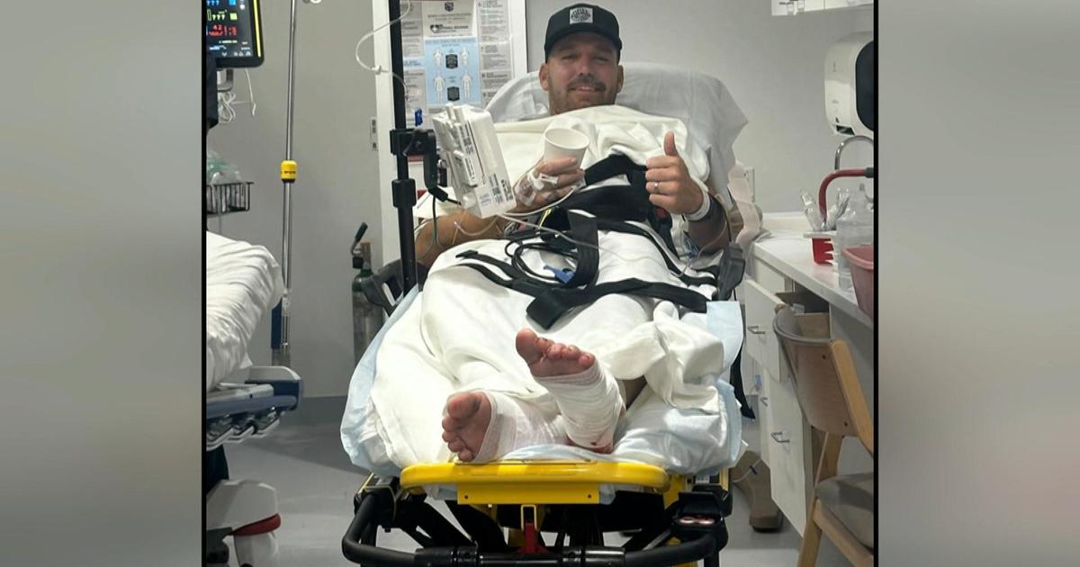 Florida surfer survives second shark attack at the same beach