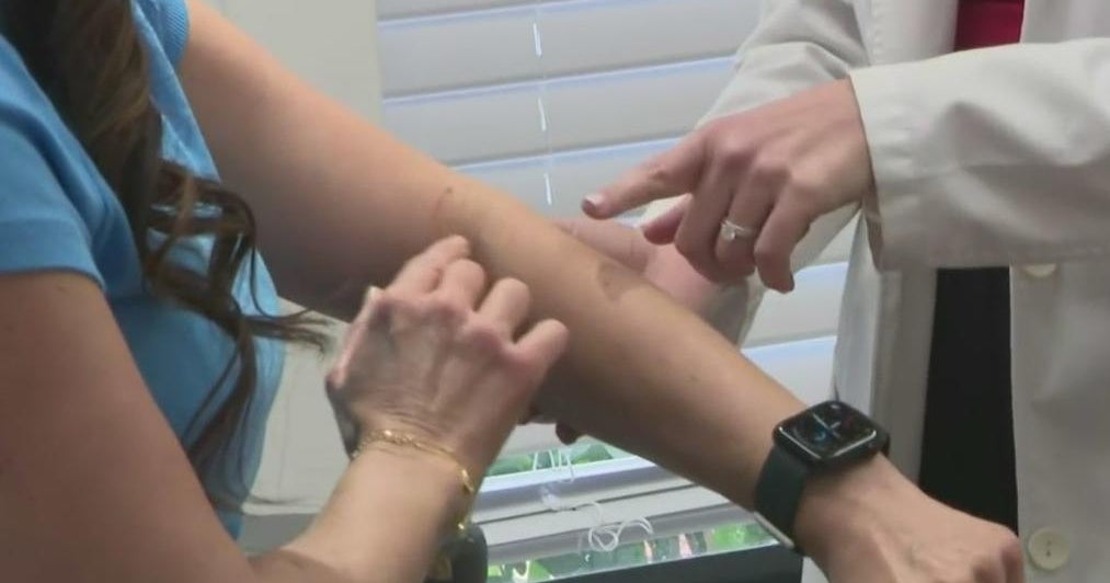 Dermatologists say there are ways to treat menopause’s affect on skin and hair