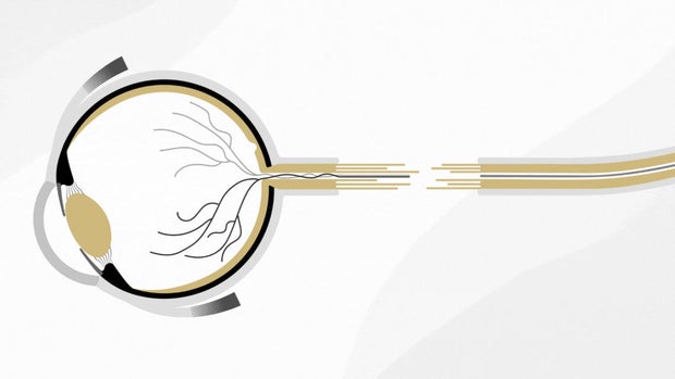 curing-blindness-grx.jpg