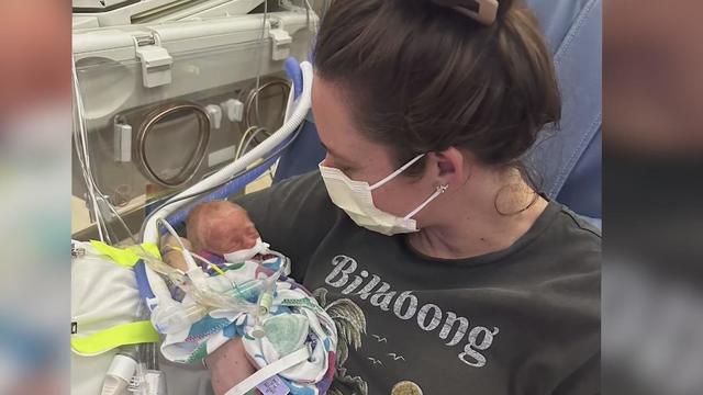 kangaroo-care-preemie-120424.jpg 