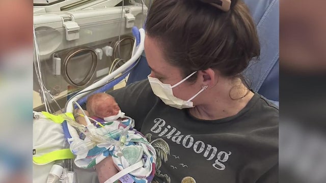 kangaroo-care-preemie-120424.jpg