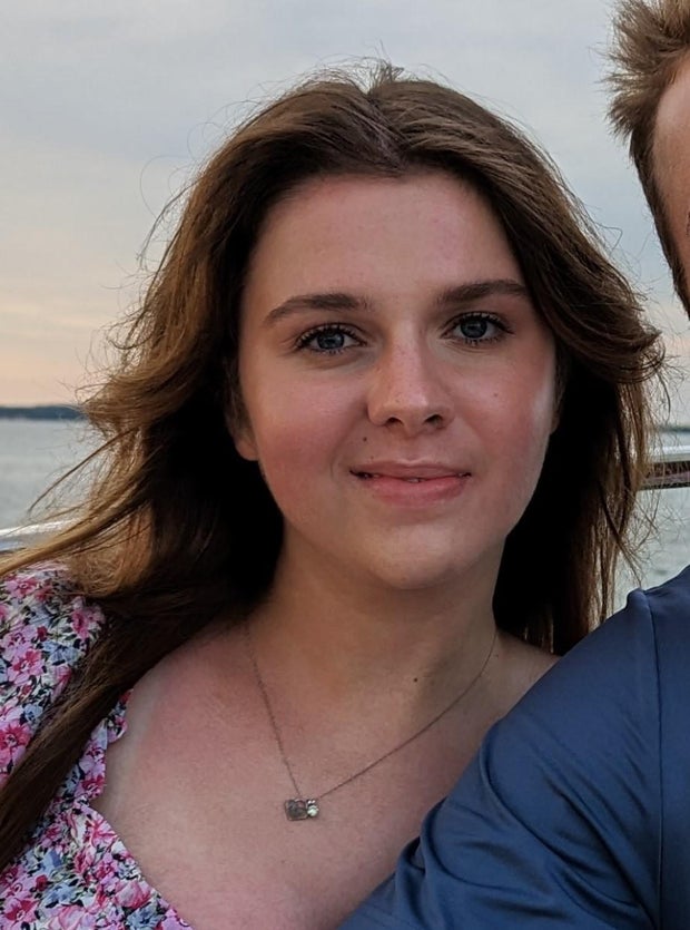 5-june-2023-about-6-months-after-i-had-my-second-nerve-graft-dec-22-the-cross-face-nerve-graft-the-corner-of-my-lip-is-no-longer-sloping-downwards-as-much.jpg