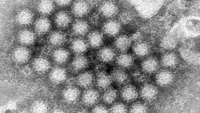 Norovirus Infections-Things to Know 