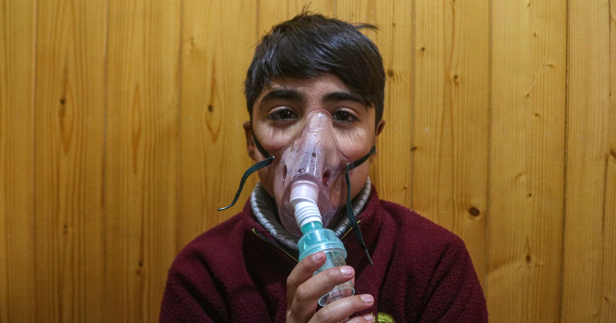 Indias first human metapneumovirus HMPV cases confirmed but officials say no reason to worry  CBS News Indias first human metapneumovirus HMPV cases confirmed but officials say no reason to worry  CBS News