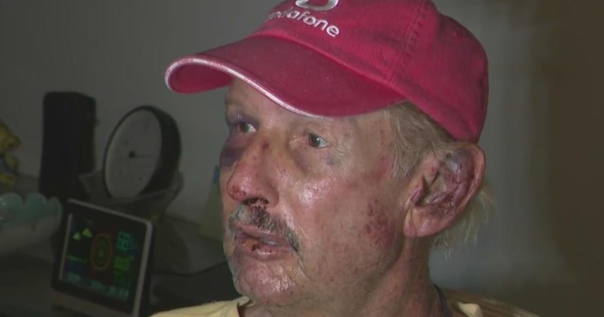 73-year-old man beaten in home invasion said he’s lucky to be alive