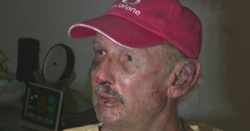 73-year-old man beaten in home invasion said he’s lucky to be alive 73-year-old man beaten in home invasion said he’s lucky to be alive