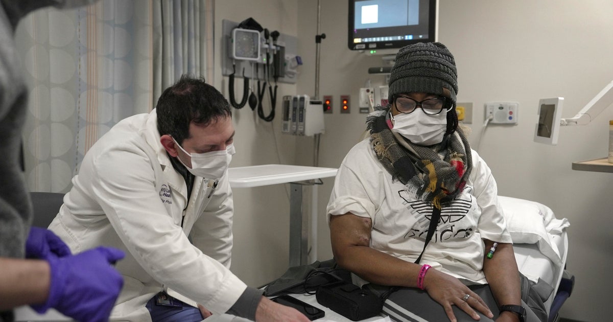 Alabama woman who is the only person in the world with a functioning pig organ is thriving after a record 2 months Alabama woman who is the only person in the world with a functioning pig organ is thriving after a record 2 months