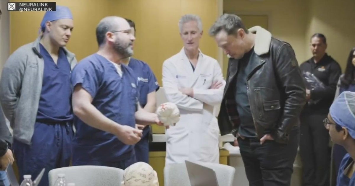 Can Elon Musk’s brain chip help cure paralysis? Here’s what you need to know Can Elon Musk’s brain chip help cure paralysis? Here’s what you need to know