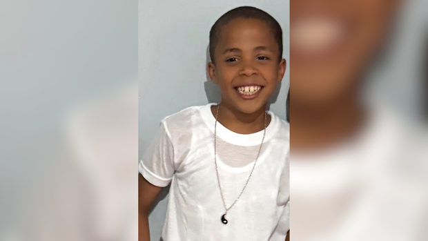 Photo of 9-year-old Ramesses, who was burned in the Philadelphia plane crash